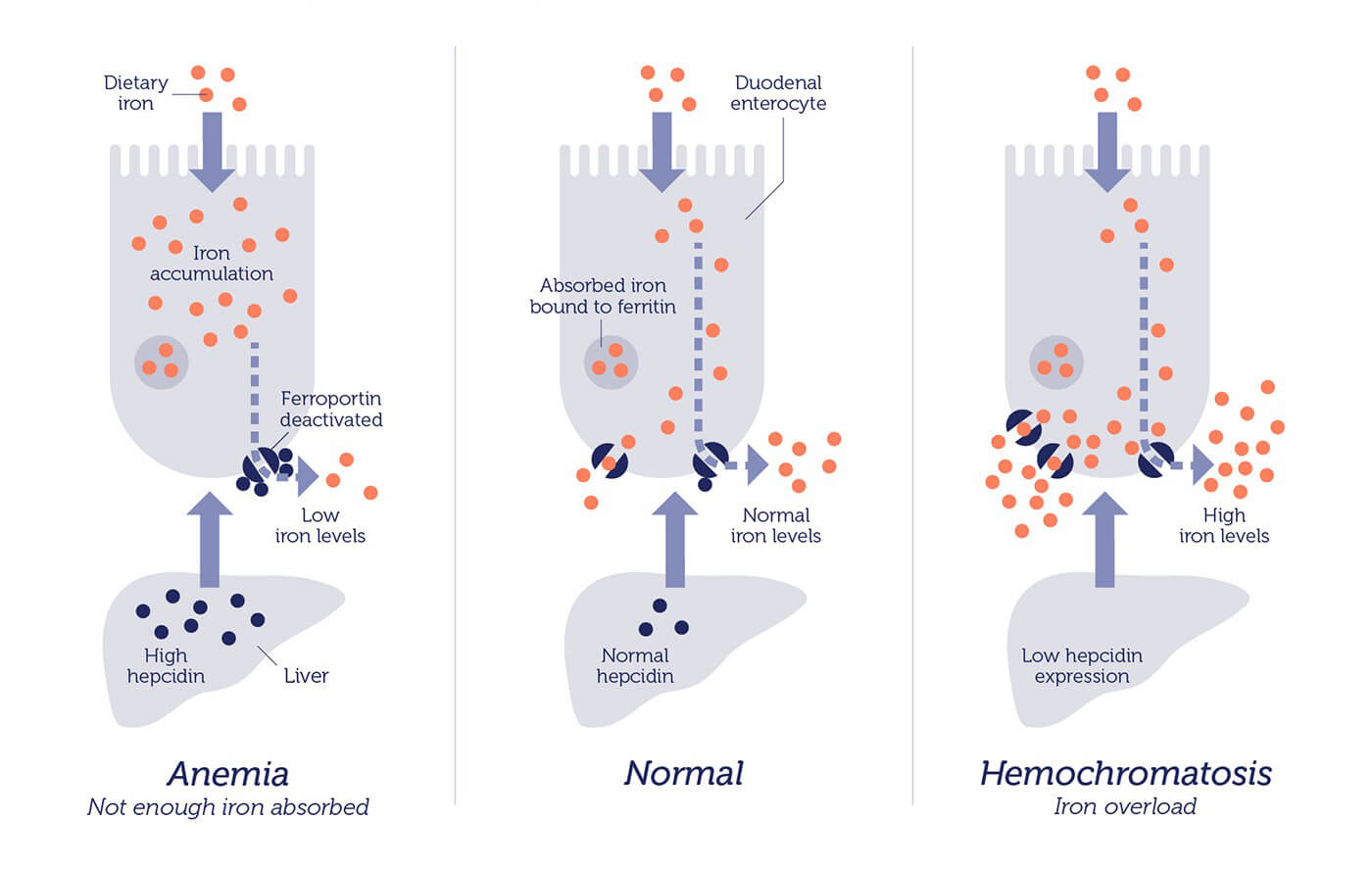 hemochromatosis gene